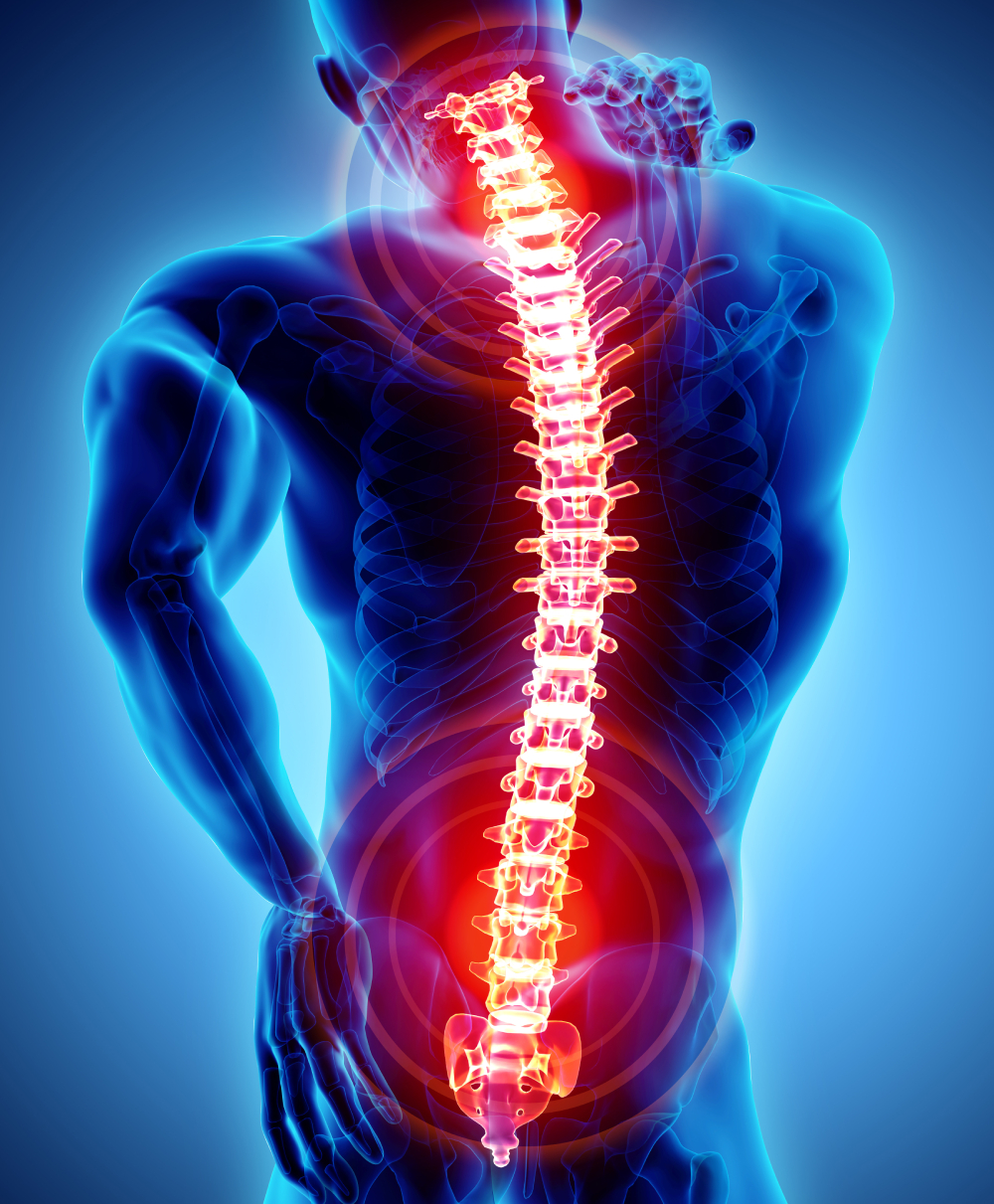 Spine Surgery